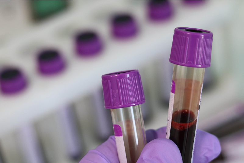 CAR-T Cells: The Programmed Cancer Killer