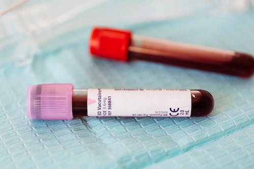 Blood-Based miRNA Tests: A Promising Tool for the Early Detection of Multiple Types of Cancer